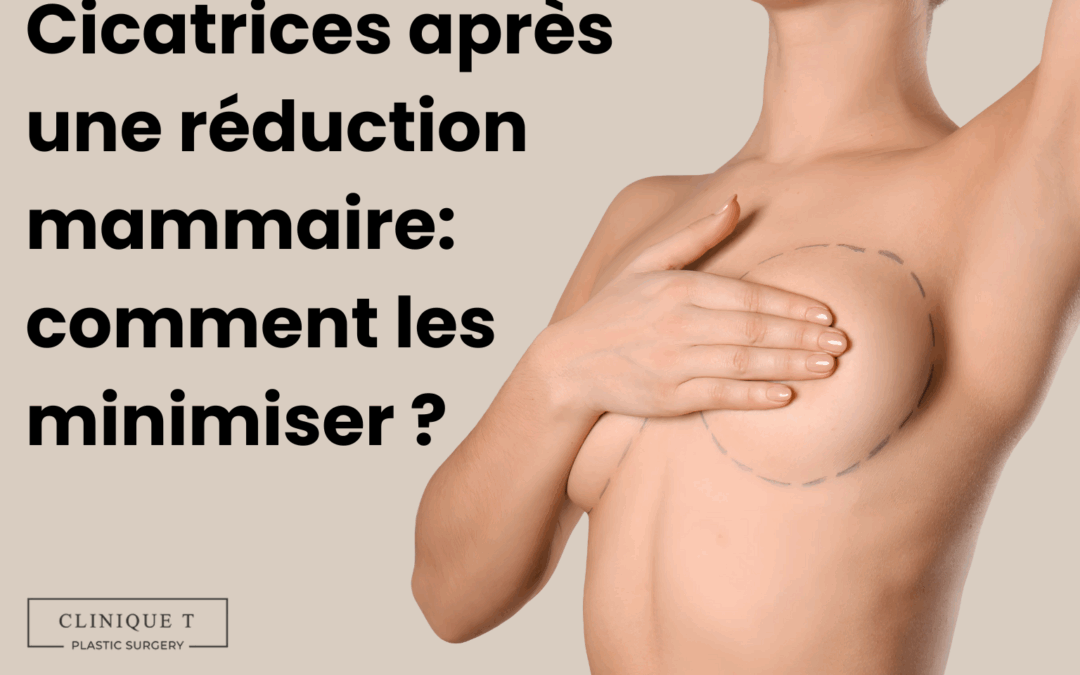 Comment atténuer les cicatrices après une réduction mammaire?