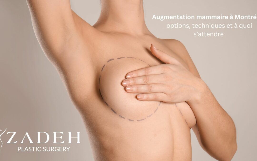 Augmentation mammaire à Montréal : options, techniques et à quoi s’attendre