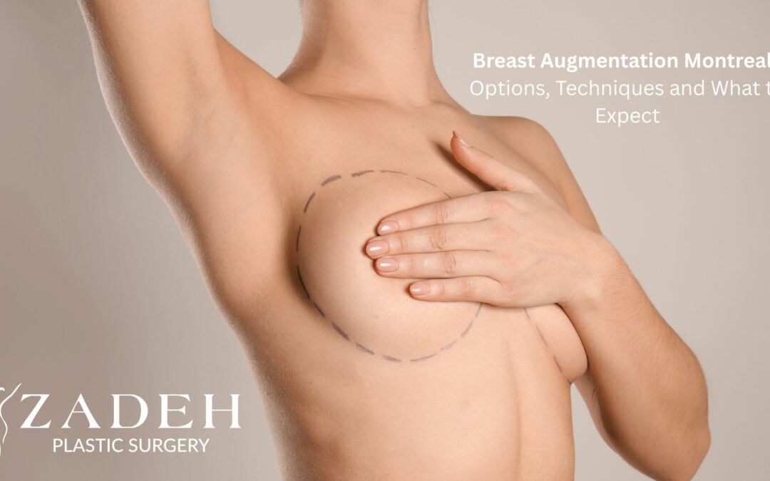 Breast Augmentation Montreal: Options, Techniques and What to Expect