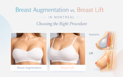 Breast Augmentation vs. Breast Lift in Montreal: Choosing the Right Procedure
