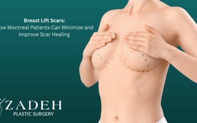 Breast Lift Scars: How Montreal Patients Can Minimize and Improve Scar Healing