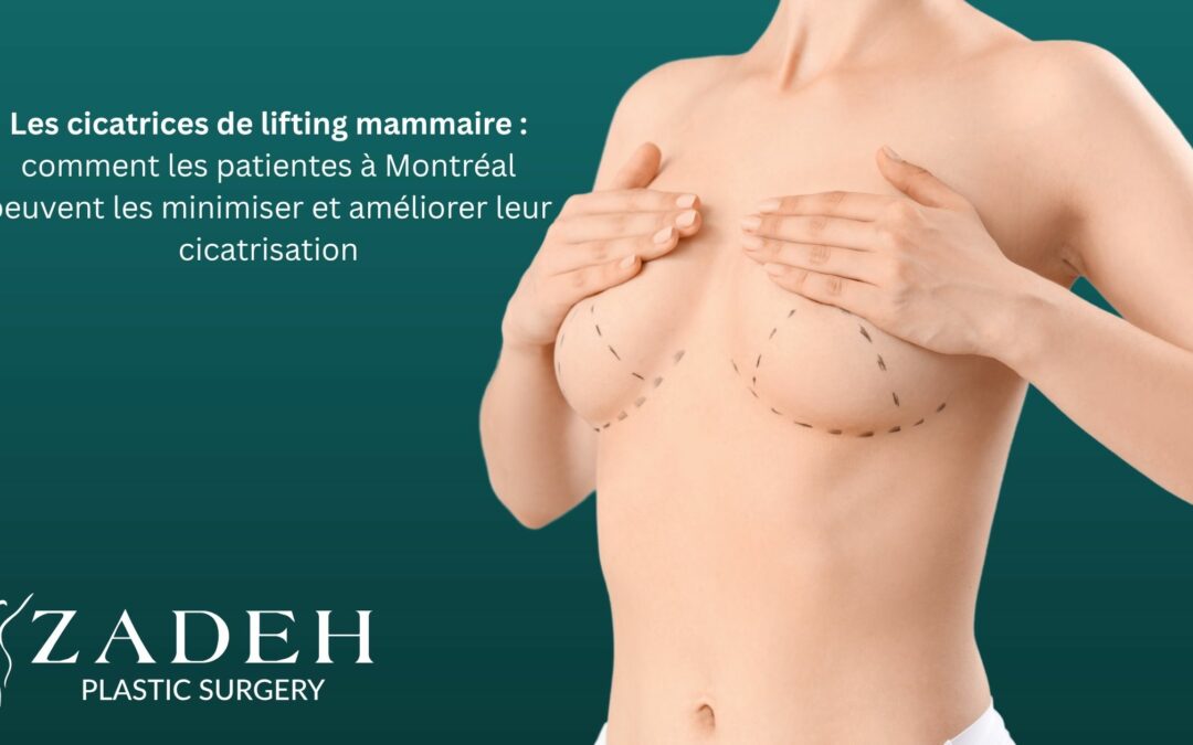 Les cicatrices de lifting mammaire : comment les patientes à Montréal peuvent les minimiser et améliorer leur cicatrisation