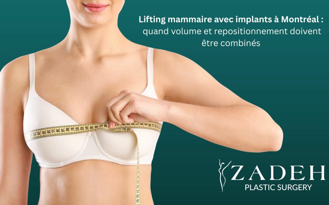 Lifting mammaire avec implants à Montréal : quand volume et repositionnement doivent être combinés